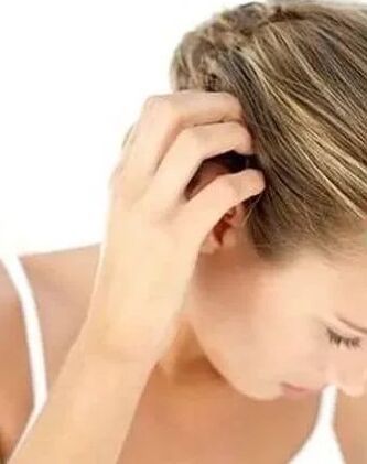 Trattamento della psoriasi