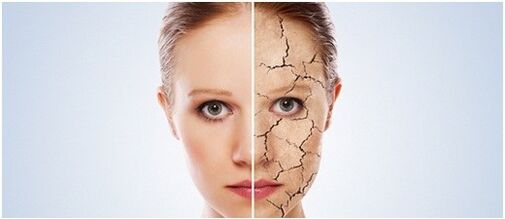 Trattiamo la psoriasi